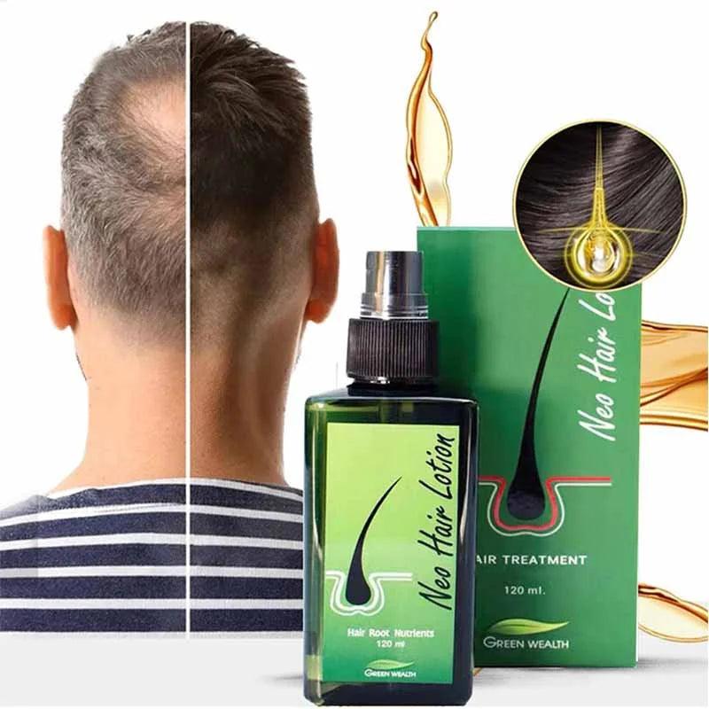 New Hair Lotion Hair Growth + FREE DERMA ROLLER